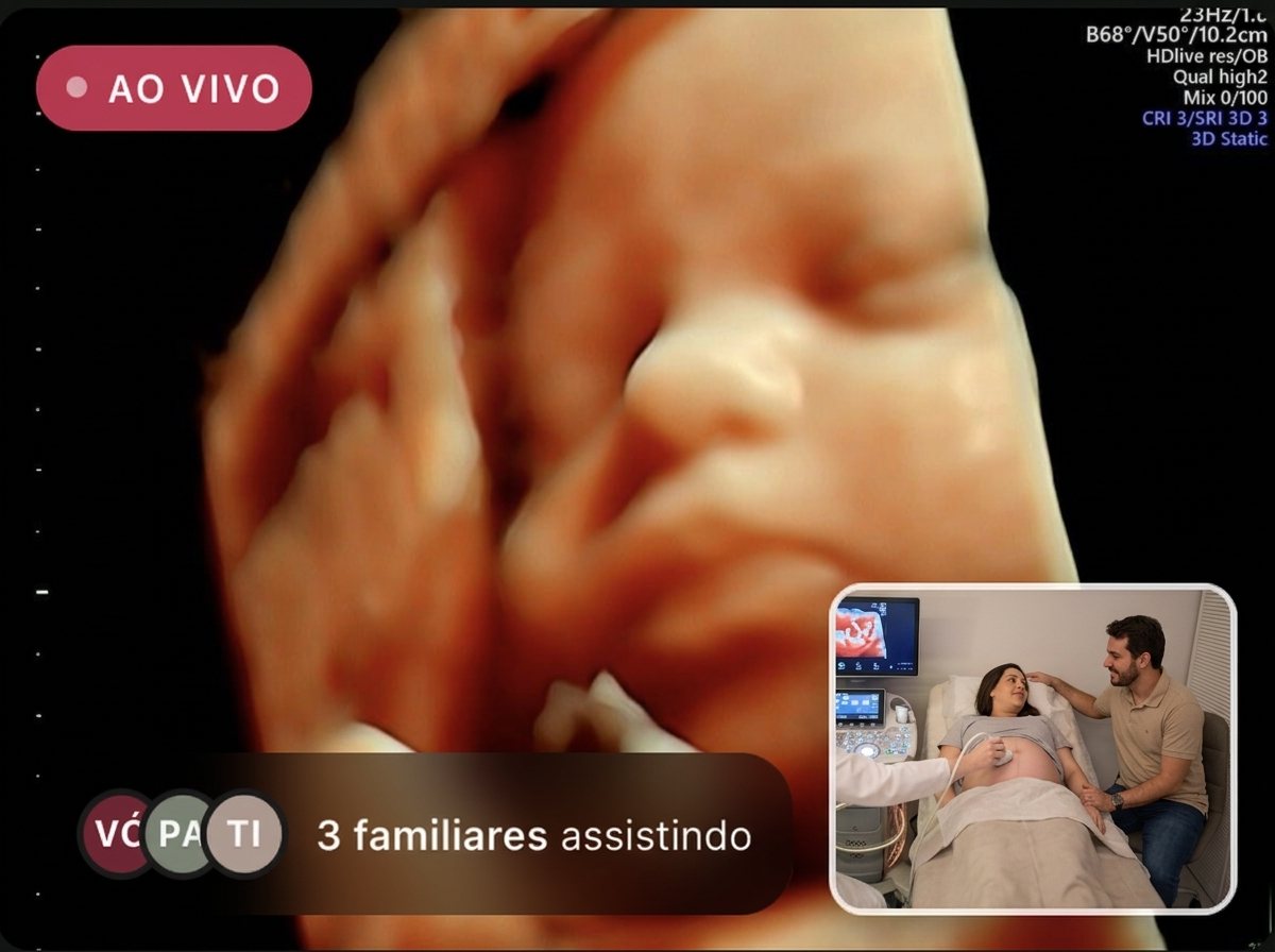 Transmissão ao vivo: imagem 3D do rosto do bebê e, no canto, a gestante na maca com o acompanhante ao lado