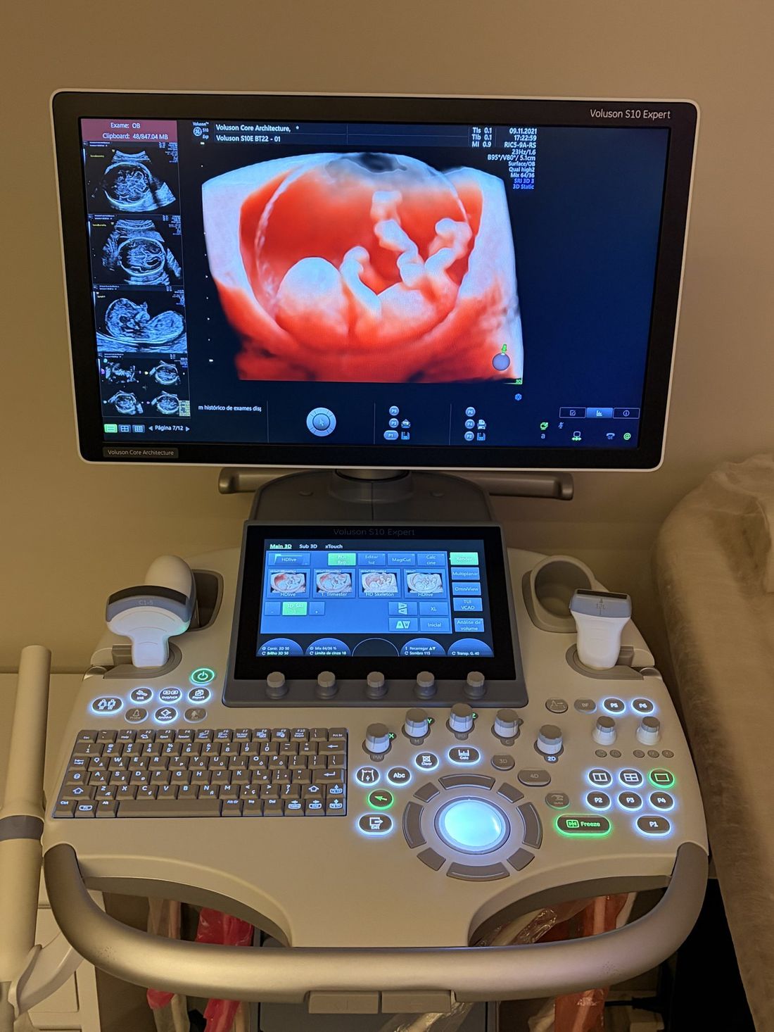 Aparelho de ultrassom Voluson S10 Expert